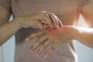 11 Skin Conditions You’ve Almost Certainly Never Heard Of