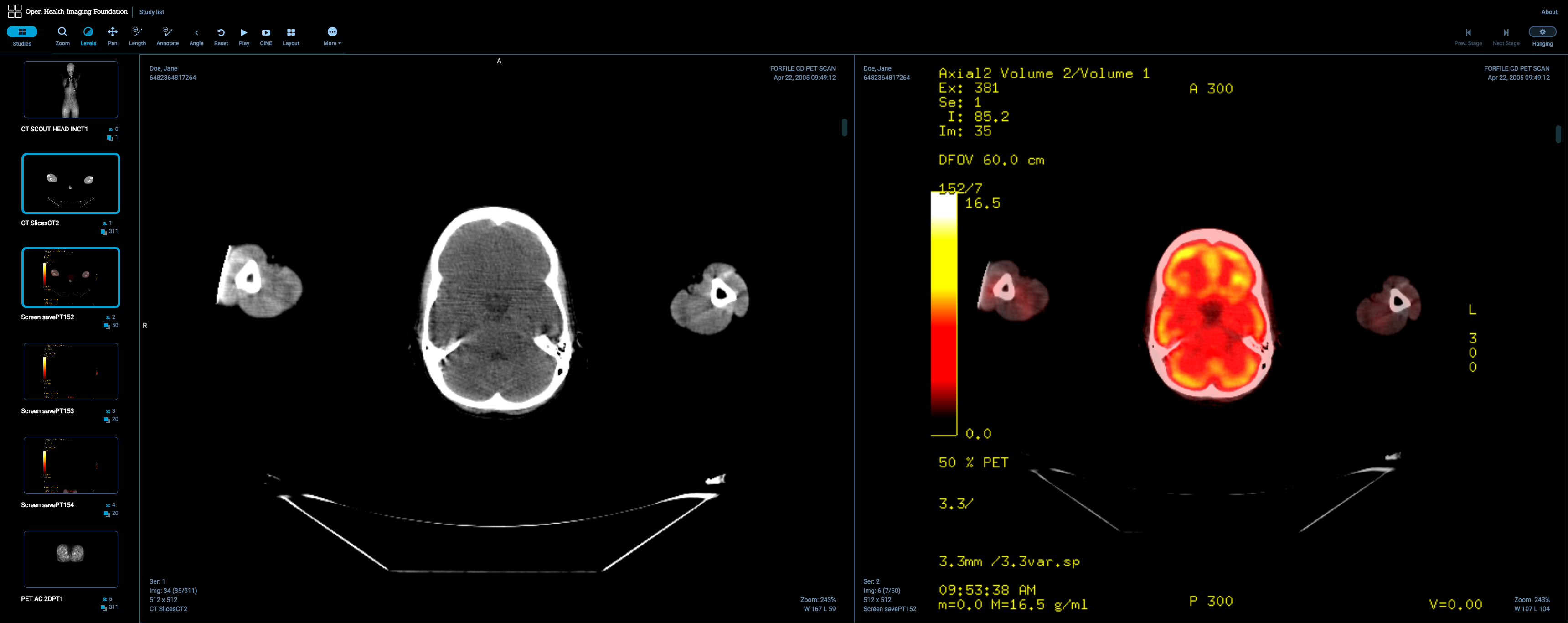 Understanding DICOM, OHIF Viewer, and PACS