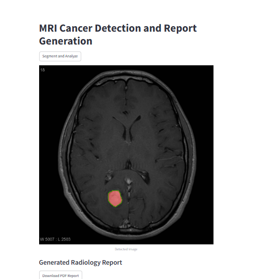 Building an AI-powered MRI Report Generation App with Streamlit and YOLOv8