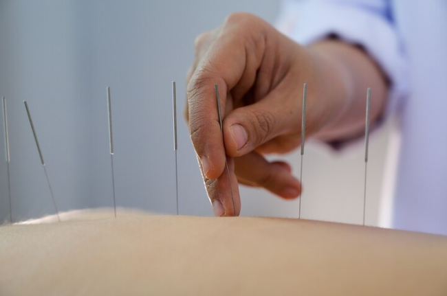 Acupuncture in Washington DC: Dupont Circle’s Premier Clinic