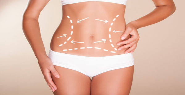The Cost of Liposuction in Dubai: A Comprehensive Guide