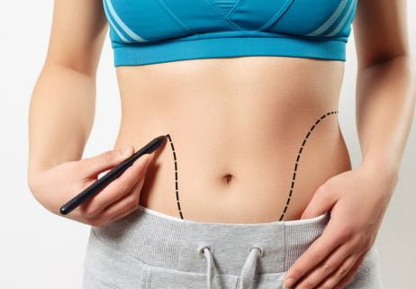 Laser Liposuction vs. Traditional Liposuction: A Comparison for Dubai Patients