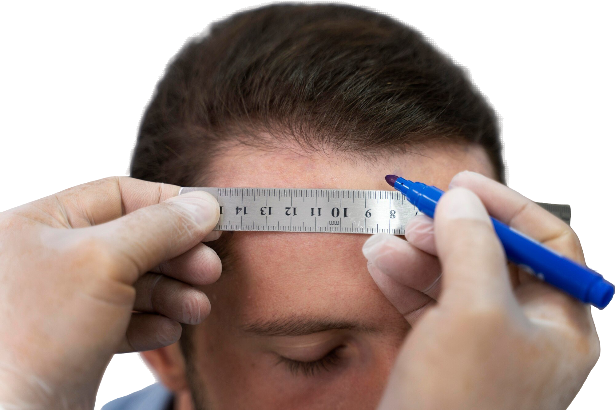 What Should We Know Before Getting a Haircut After a Hair Transplant?