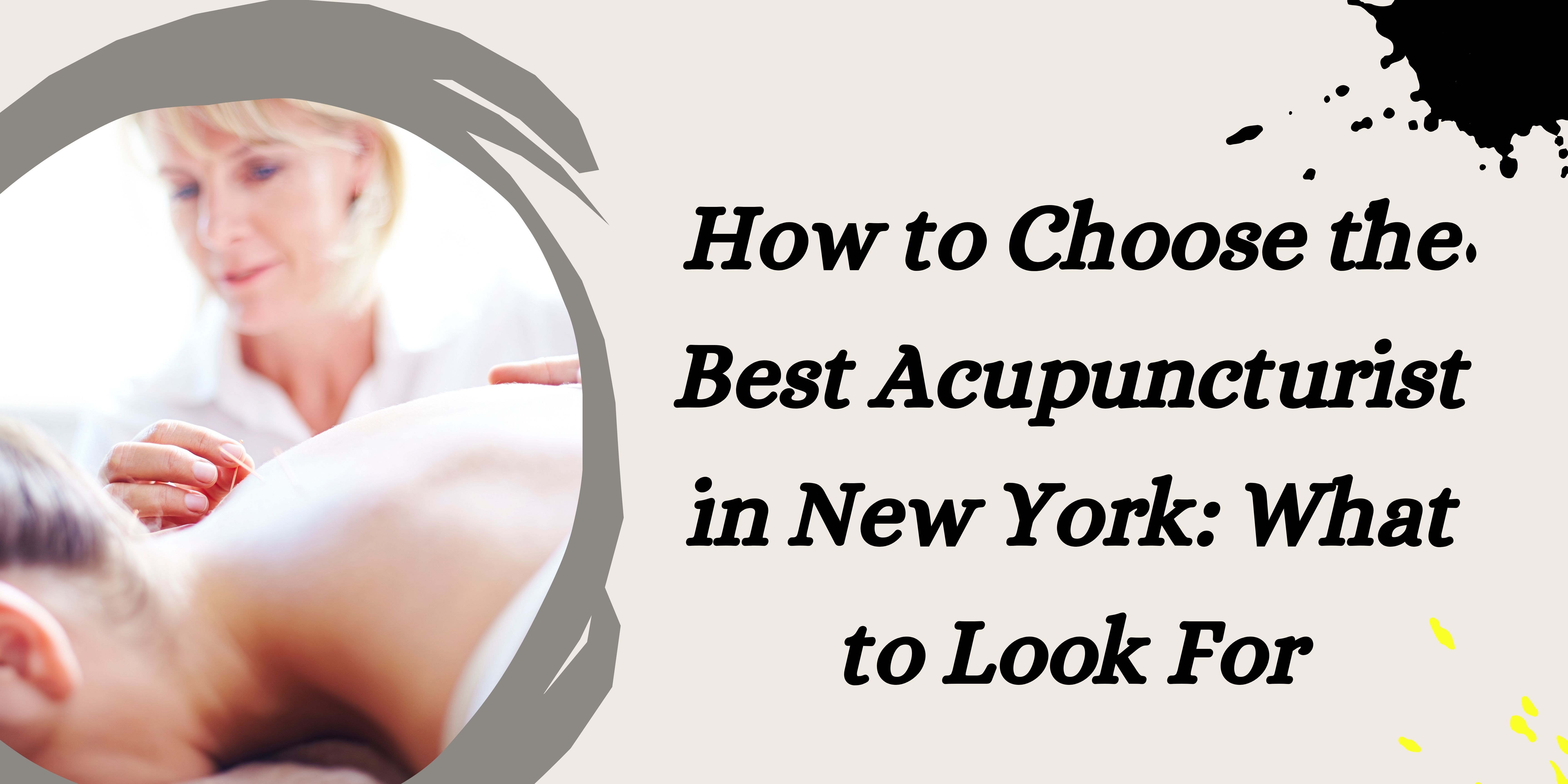 How to Choose the Best Acupuncturist in New York: What to Look For