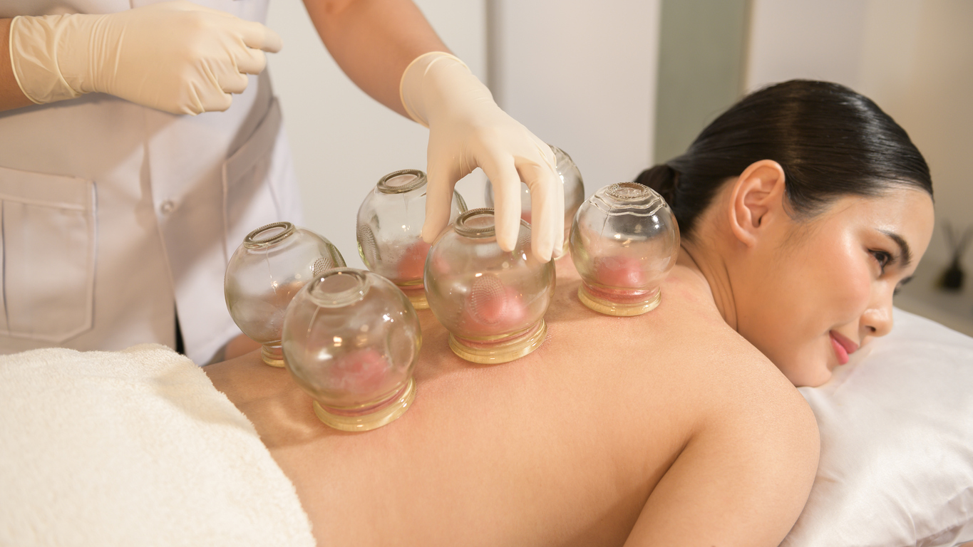 How Cupping Therapy Restores Balance And Reduces Pain In San Diego