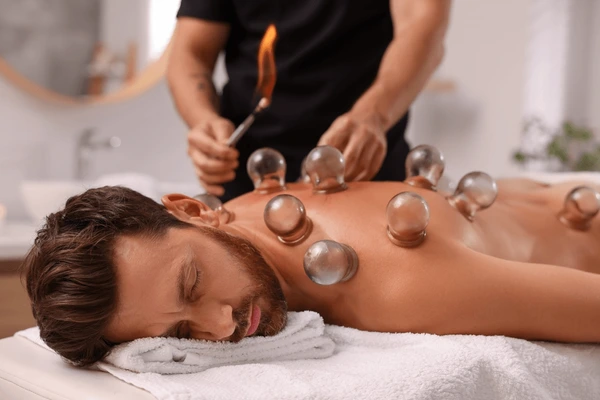 Achieving Holistic Wellbeing Through Cupping Therapy in San Diego