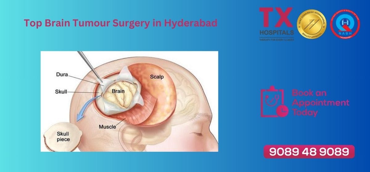 Brain Tumour Procedure in Hyderabad