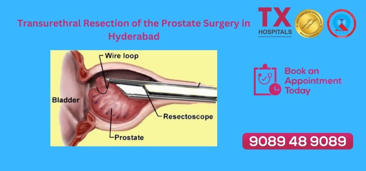 Best Doctors for TURP Surgery in Hyderabad