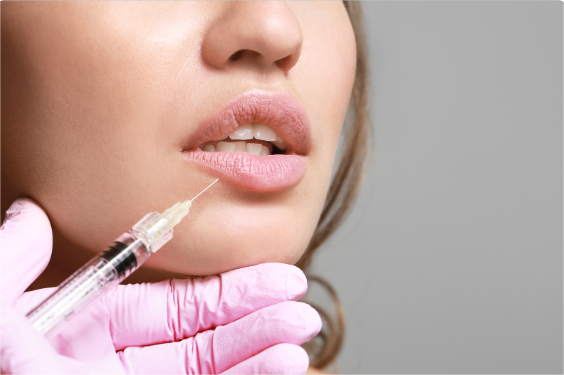 Achieve Perfect Lips with Top Lip Fillers in Pasadena