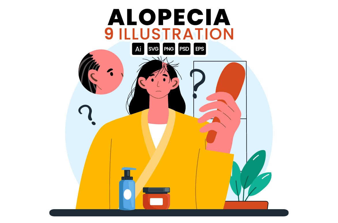 Alopecia Awareness: Vector Illustrations in Healthcare Communication