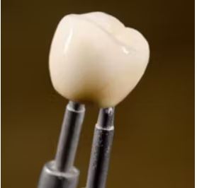 Dental implants perth