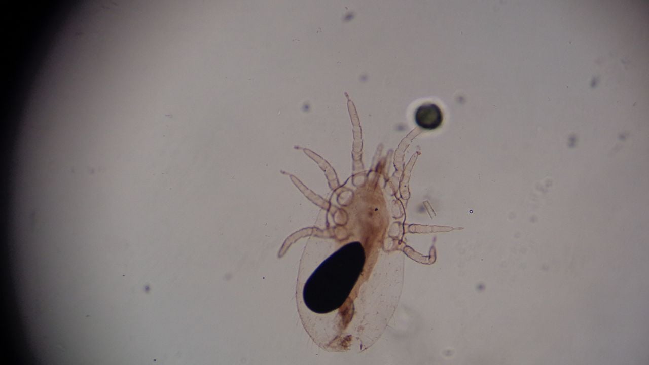 Sarcoptes scabiei