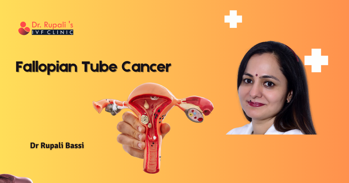 Fallopian Tube Cancer