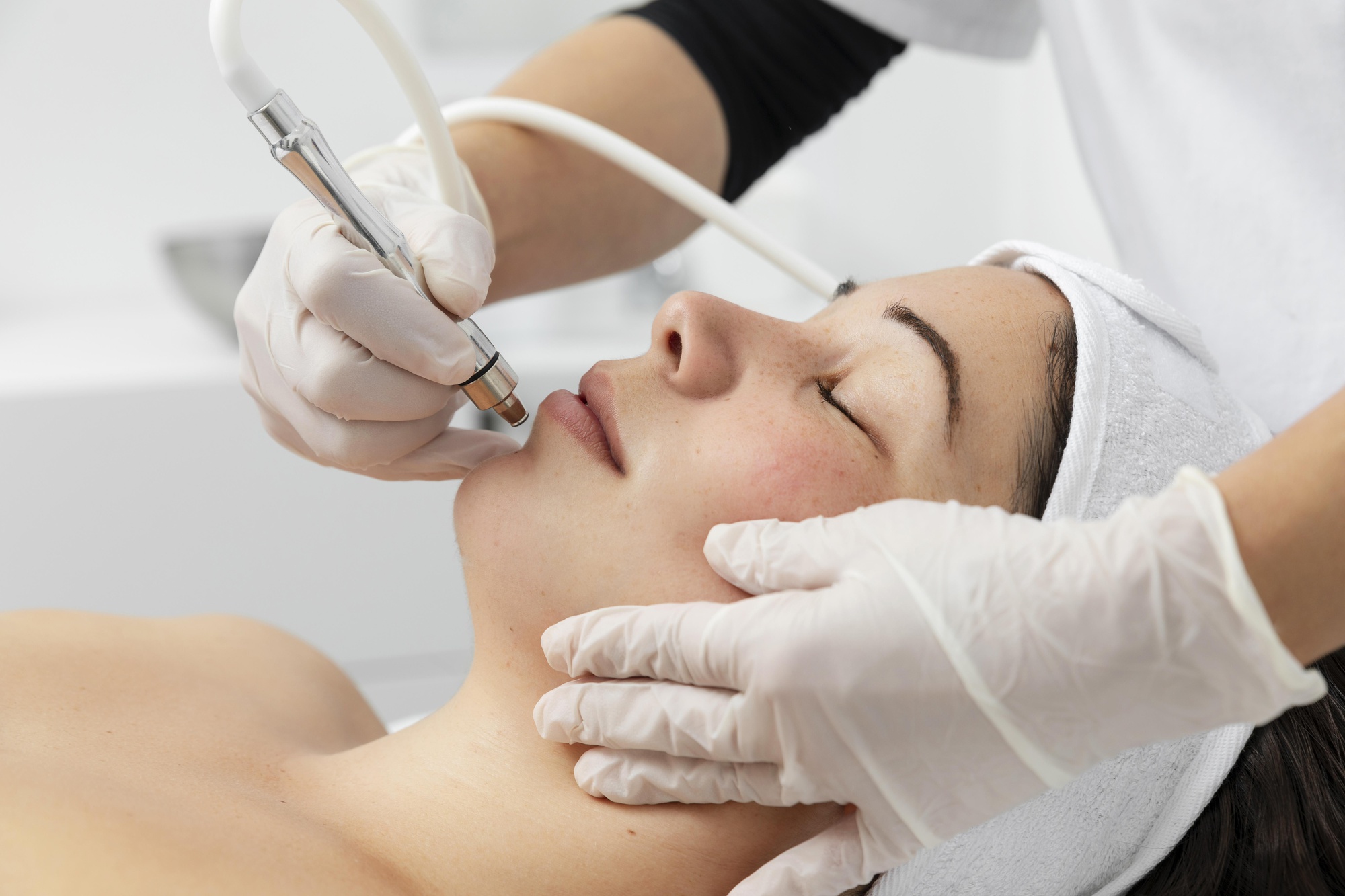 Why Hydrafacials Are Perfect for Sensitive Skin