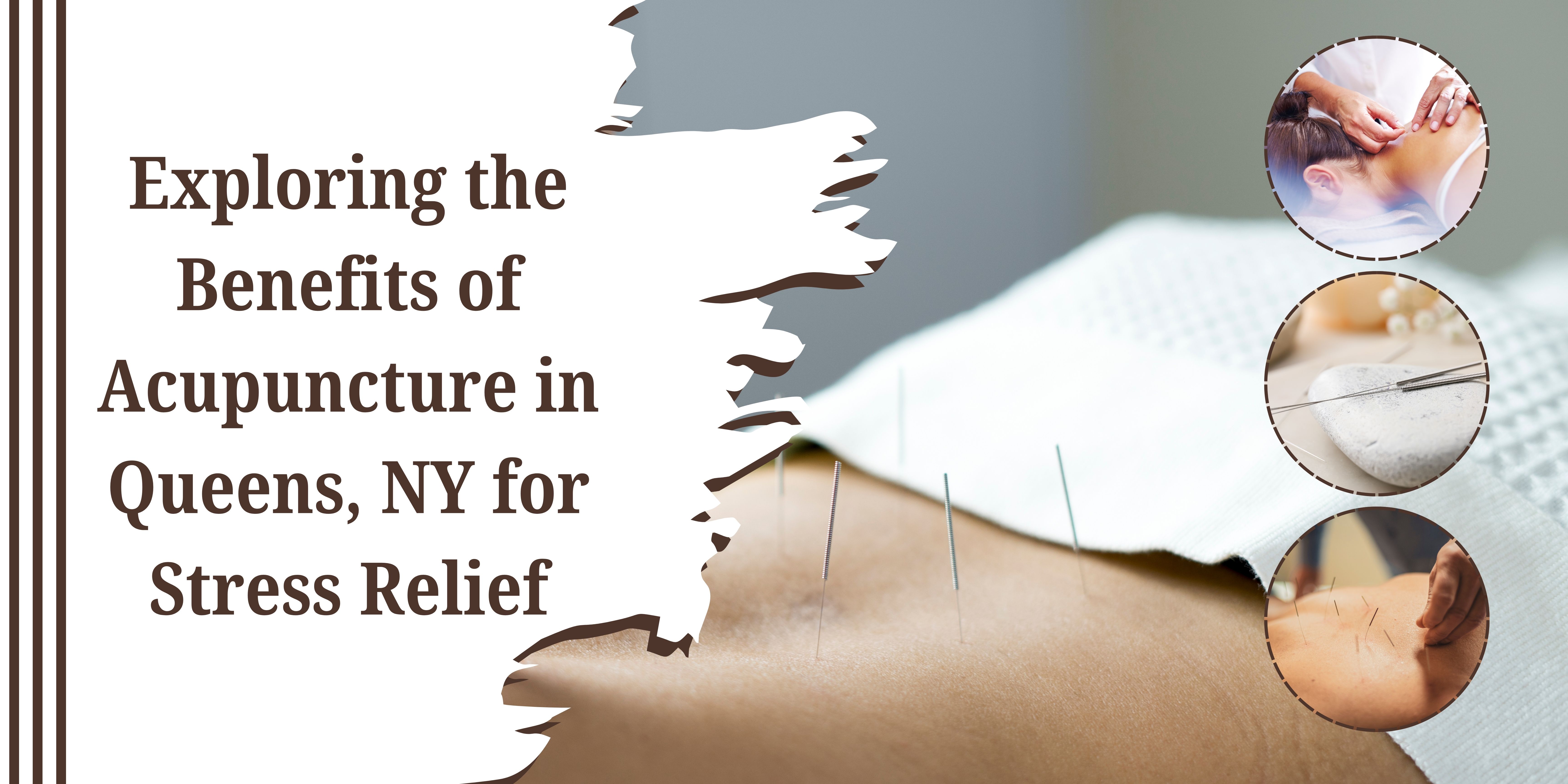 Exploring the Benefits of Acupuncture in Queens, NY for Stress Relief