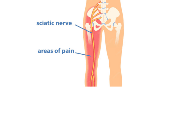 Sciatic nerve in human body