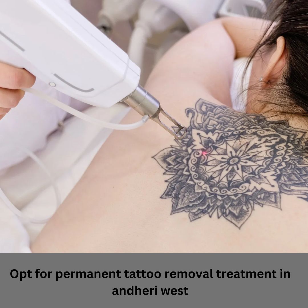 Opt for permanent tattoo removal treatment in andheri west