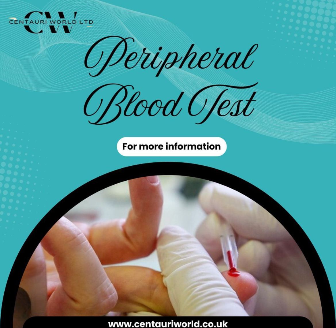 Book a Blood Test in Havering: A Guide to ACF Cannula and ACF Arm