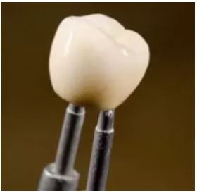 Dental Implants Melville