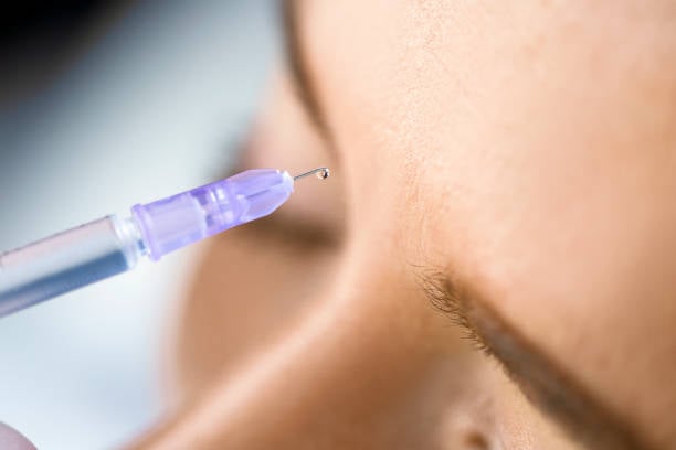 أفضل تقنيات الحقن التجميلي في الرياض للحصول على وجه مشرق