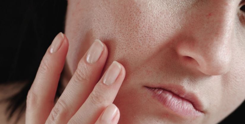 Exploring Treatment Costs for Large Pores A Detailed Look