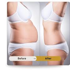Transform Your Look at Elite Body Home: The Leading Aesthetic Polyclinic