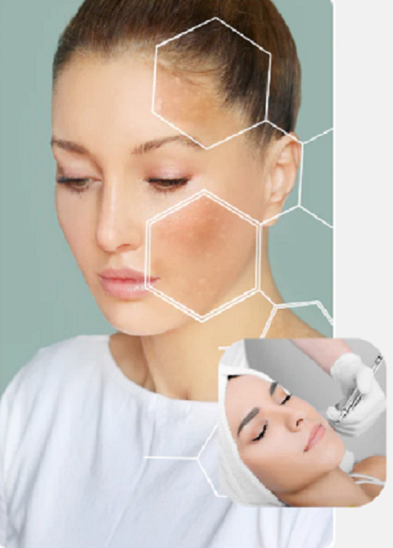 Transform Your Skincare Routine with Chara Omni Coupons Code Deals.