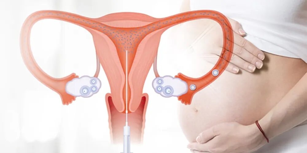 How to Spot a Fake: Red Flags When Choosing an IUI Hospital