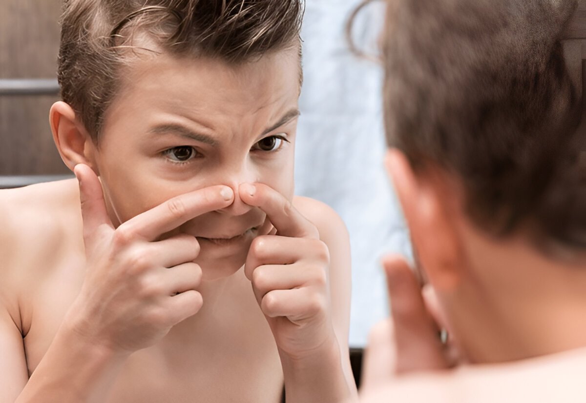 Teenage Skincare Mistakes and How to Fix Them