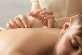 Learn How Acupuncture Can Solve Insomnia