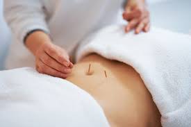 Acupuncture for Fertility: Can it Enhance Conception and Pregnancy Outcomes