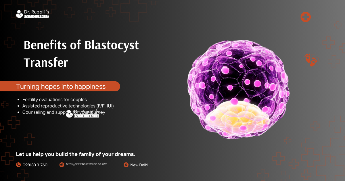 Benefits of Blastocyst Transfer