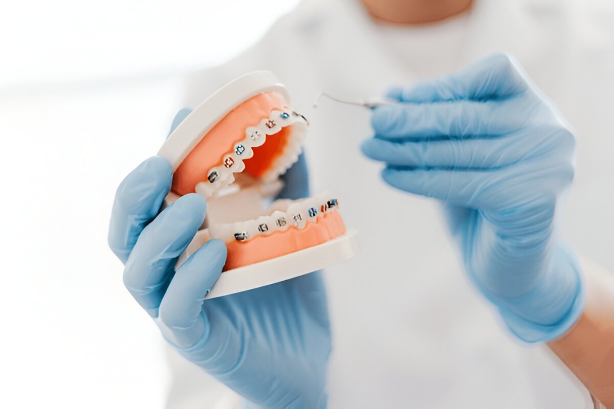 Orthodontist Massapequa NY