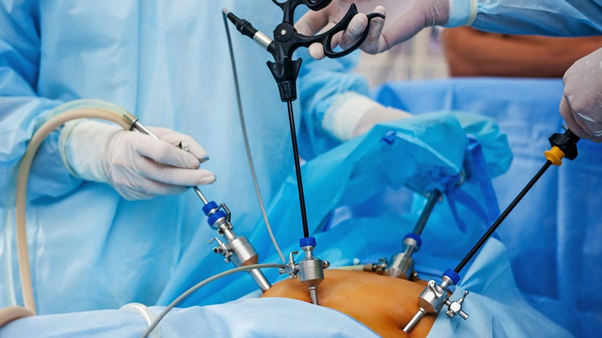 What Happens to Your Body After a Total Laparoscopic Hysterectomy?