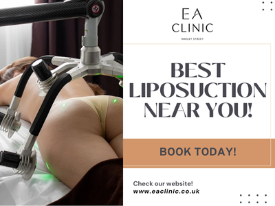 Looking For Liposuction Near You?