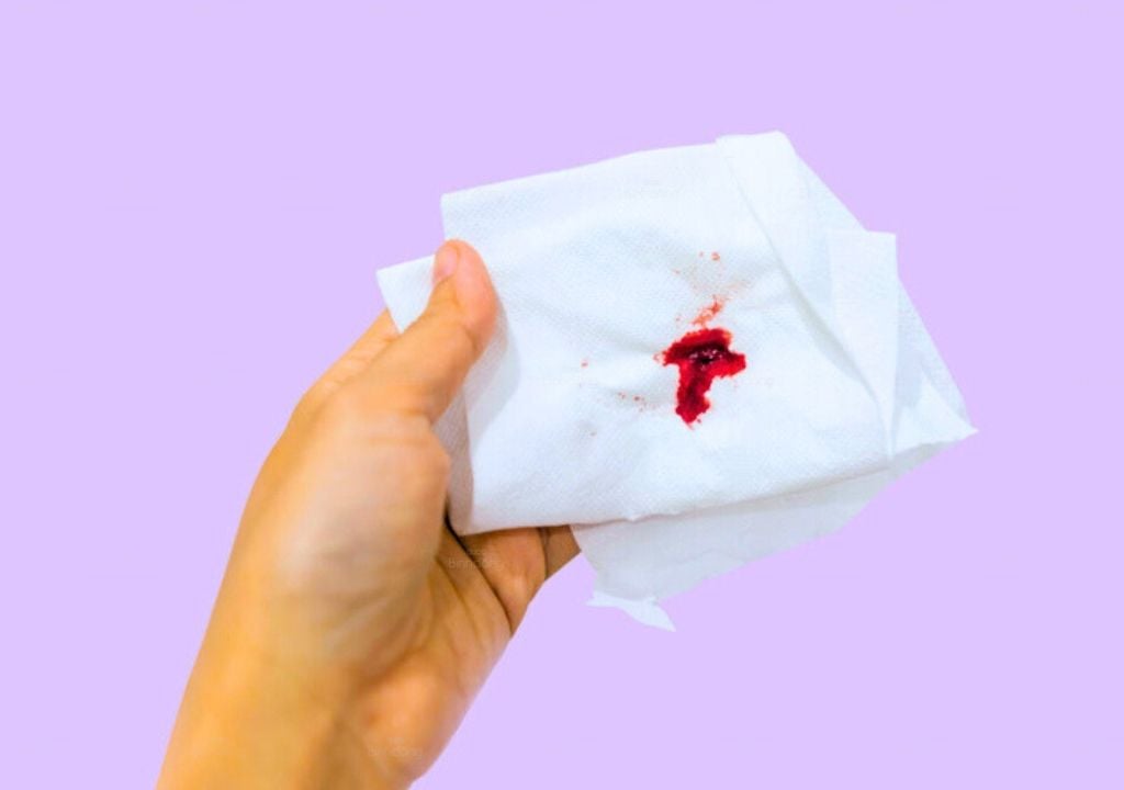 Nguyên Nhân Khiến Kinh Nguyệt Ra Ít Mà Bạn Không Nên Bỏ Qua