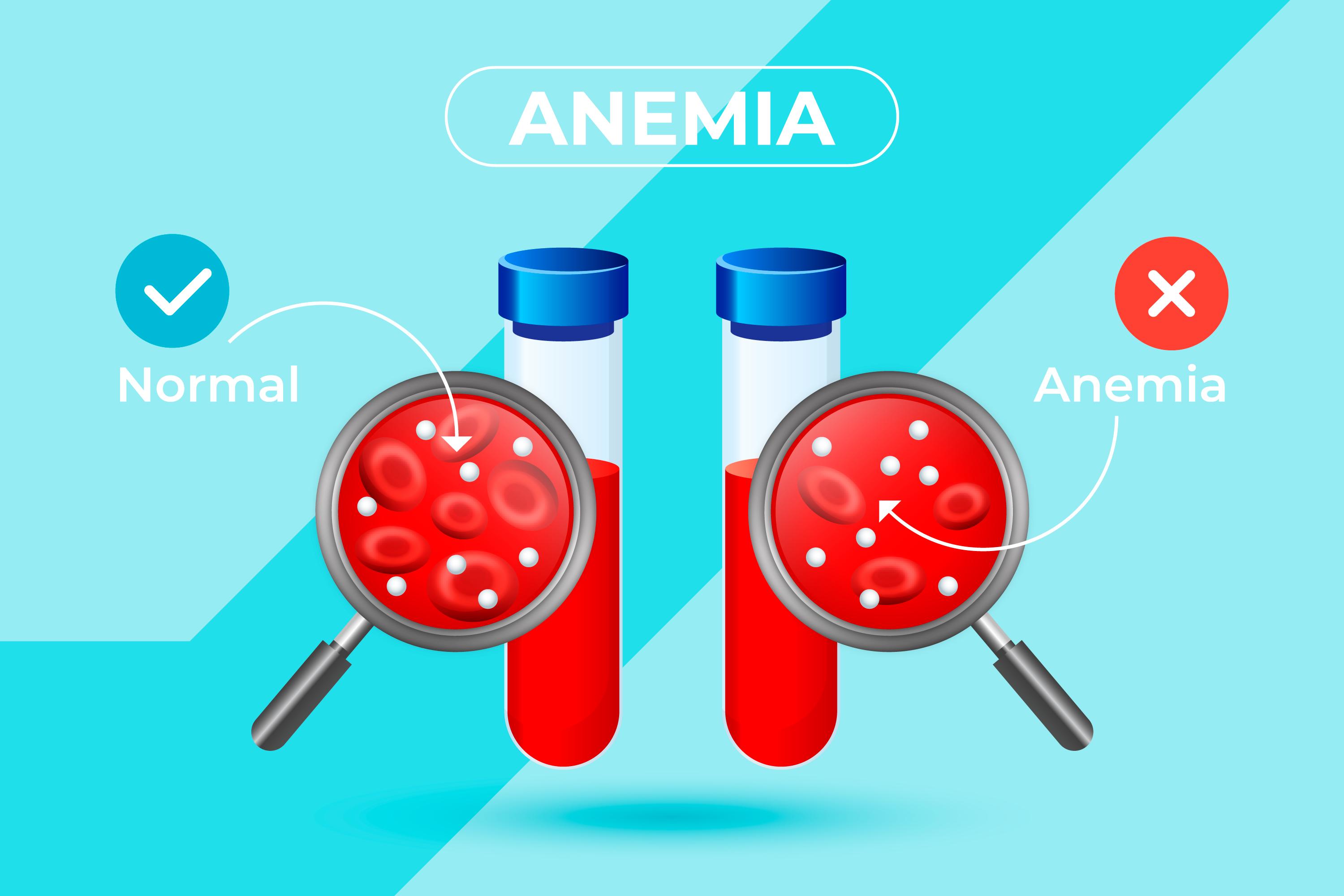 The Ironclad Opportunity: Decoding the Iron-Deficiency Anemia Test Market