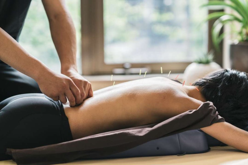 Acupuncture Adelaide