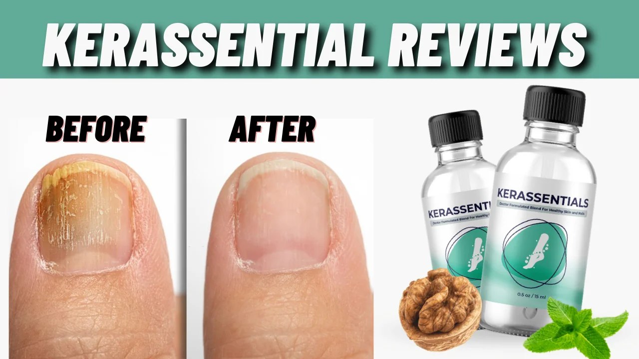 Kerassentials — [TOP 5 BENEFITS 2025!] With PRICE?