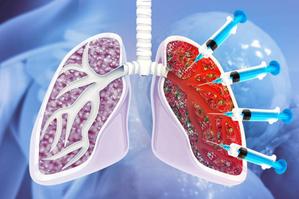 Expert Pulmonary Care at VIMS: Pulmonologist in Salem | Top Lungs Specialist in Salem