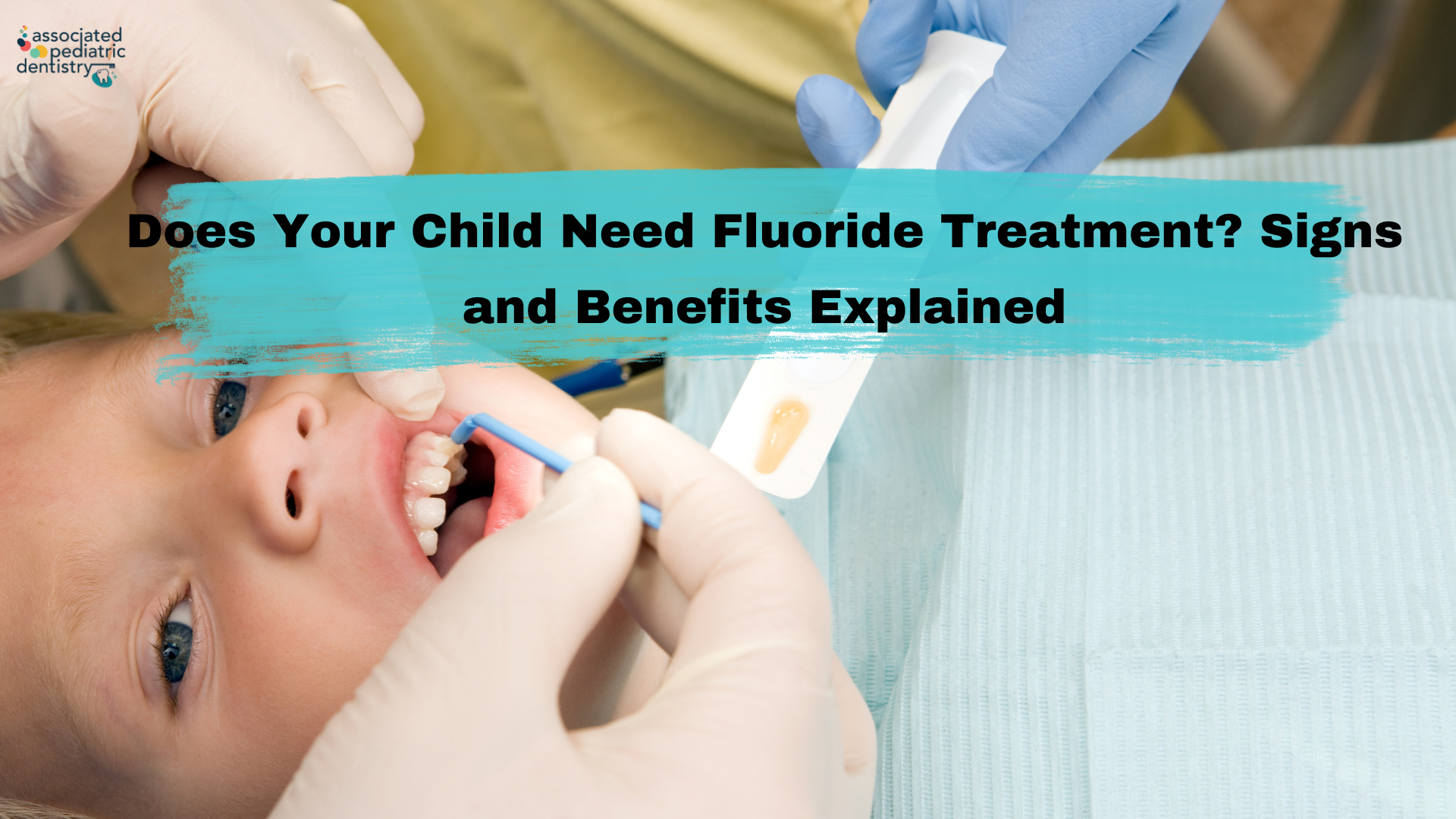 Does Your Child Need Fluoride Treatment? Signs and Benefits Explained