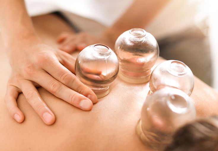 10 Amazing Benefits of Cupping Massage for Your Body and Mind