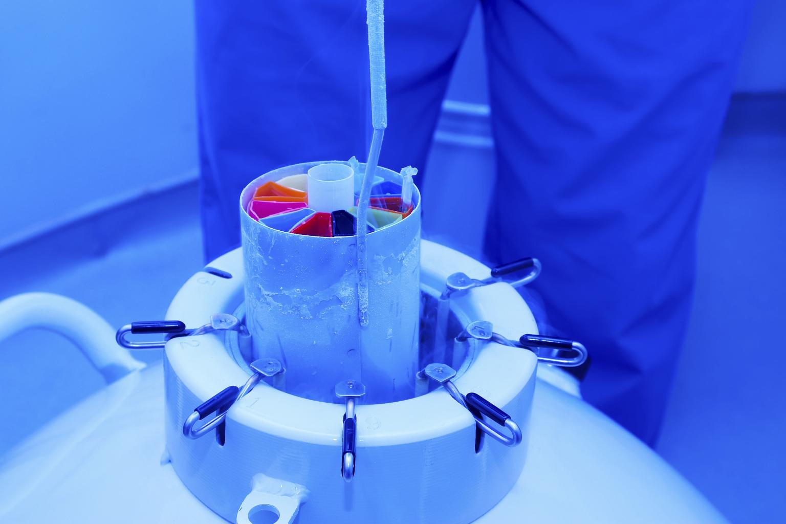 Cryopreservation Equipment Market is Estimated to Witness High Growth Owing to Rising Demand for Long-Term Preservation of Human Organs and Stem Cells