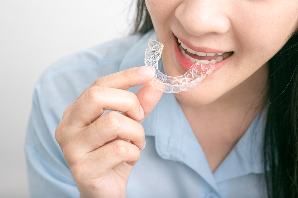 How to Properly Care for Your Clear Retainers to Extend Their Life