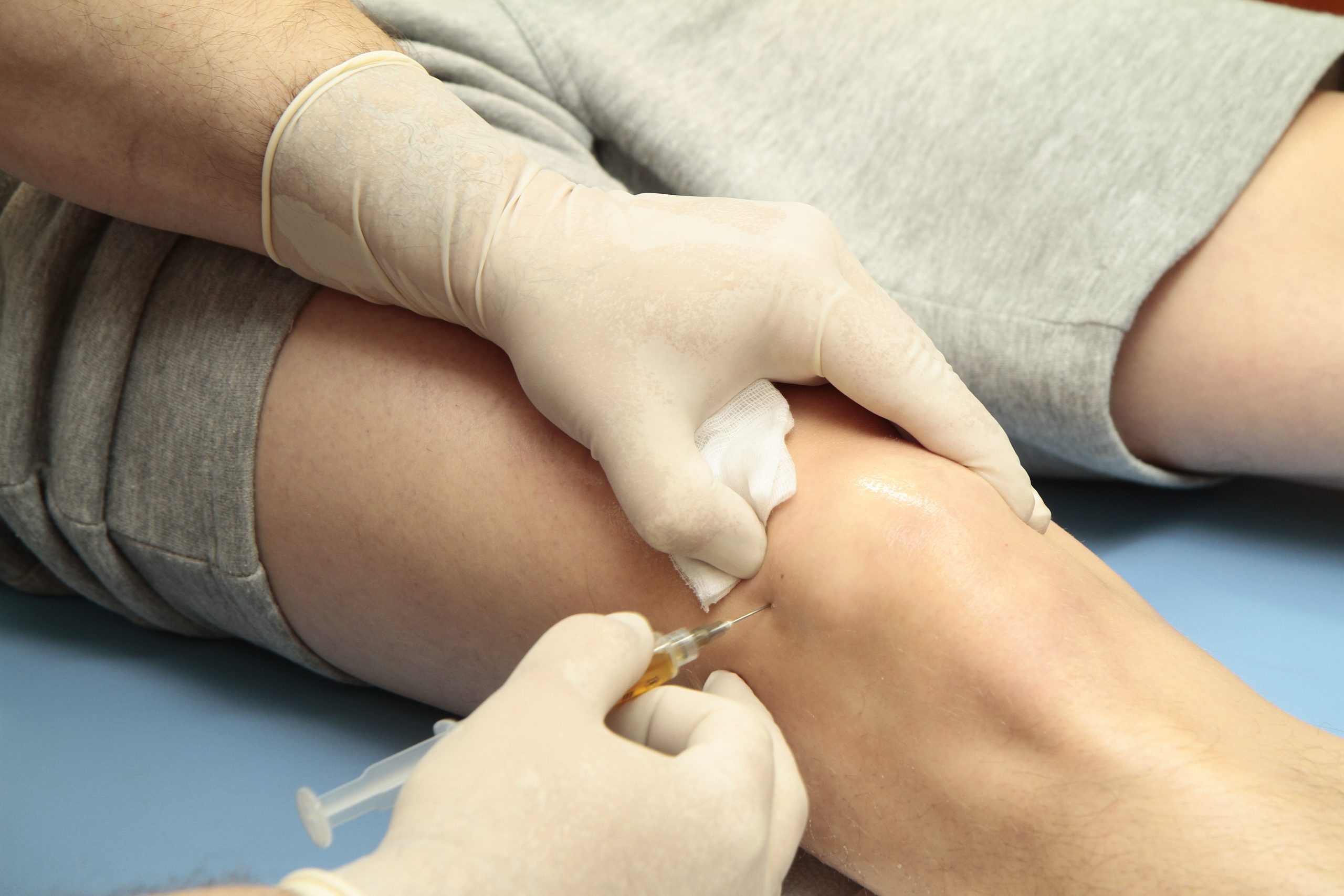 Stem Cell Therapy
