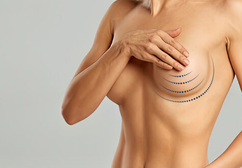 Breast Reduction Without Surgery: Is It Possible?