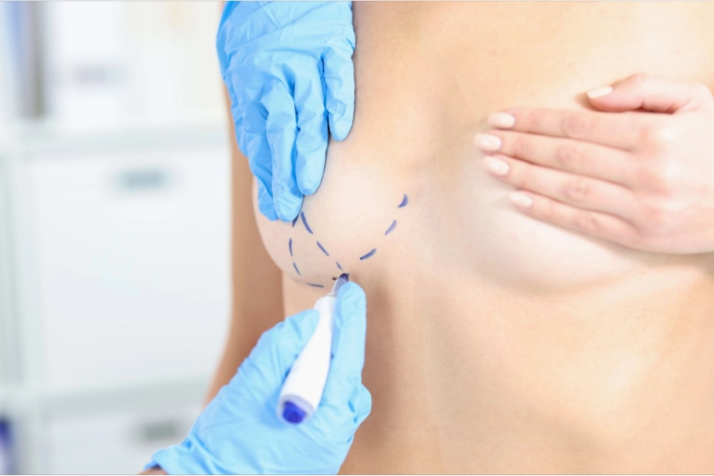 How Breast Reduction Helps with Skin Irritation and Rashes
