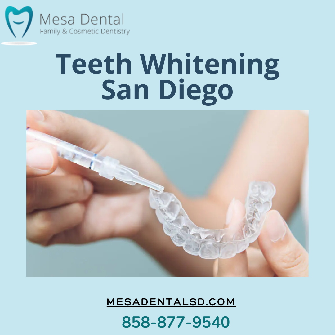 Enhance Your Smile: Teeth Whitening and Dental Implants in San Diego
