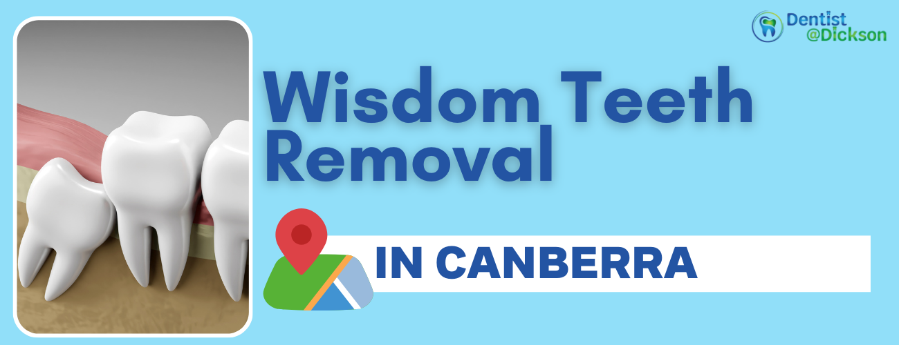 Get Relief from Pain & Discomfort With Wisdom Teeth Removal In Canberra