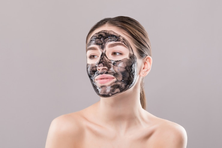 Is Laser Carbon Peel Good for Acne-Prone Skin?